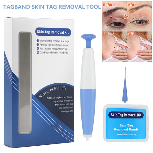 Skin Tag Removal Kit Home Use Mole Wart Remover