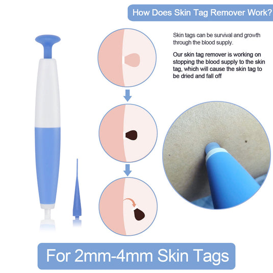 Skin Tag Removal Kit Home Use Mole Wart Remover